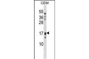 Western blot analysis in CEM cell line lysates (35ug/lane). (Kallikrein 15 抗体  (AA 78-106))