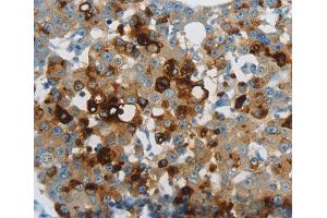 Immunohistochemistry (IHC) image for anti-Lipocalin 2 (LCN2) (AA 1-100) antibody (ABIN3017526) (Lipocalin 2 抗体  (AA 1-100))