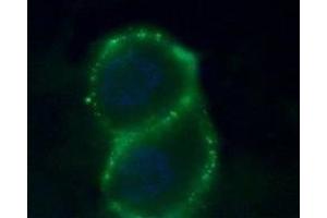 Expression of Zinc-activated channel in human PANC-1 cells - Cell surface detection of Zinc-activated channel in human intact living pancreatic adenocarcinoma (PANC-1) cells. (ZACN 抗体  (Extracellular))