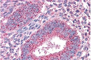 Immunohistochemistry (IHC) image for anti-Protein Tyrosine Phosphatase, Receptor Type, M (PTPRM) (Internal Region) antibody (ABIN238629)