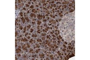 Immunohistochemical staining of human pancreas with NUDT22 polyclonal antibody  shows strong cytoplasmic positivity in exocrine glandular cells at 1:20-1:50 dilution. (NUDT22 抗体)