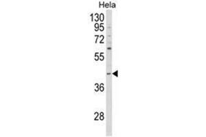 Western blot analysis of NCK1 Antibody (N-term) in Hela cell line lysates (35ug/lane). (NCK1 抗体  (N-Term))