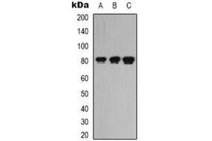 Western blot analysis of LRRC41 expression in K562 (A), rat kidney (B), rat heart (C) whole cell lysates. (LRRC41 抗体)