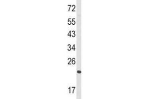 Western Blotting (WB) image for anti-RAN, Member RAS Oncogene Family (RAN) (AA 12-39) antibody (ABIN3032431)