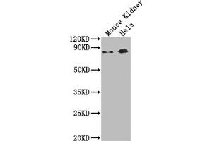Western Blot Positive WB detected in: Mouse Kidney tissue, Hela whole cell lysate All lanes: Ripk1 antibody at 1:2000 Secondary Goat polyclonal to rabbit IgG at 1/50000 dilution Predicted band size: 75 kDa Observed band size: 75 kDa (RIPK1 抗体  (AA 1-656))