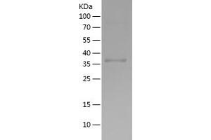 GDF2 Protein (AA 320-429) (His-IF2DI Tag)