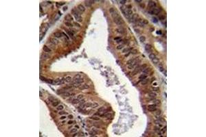 Immunohistochemistry (Paraffin-embedded Sections) (IHC (p)) image for anti-tyrosyl-DNA phosphodiesterase 2 (TDP2) (AA 253-281), (C-Term) antibody (ABIN955389)