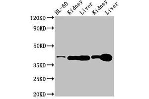 Western Blot Positive WB detected in: HL60 whole cell lysate, Rat kidney tissue, Rat liver tissue, Mouse kideny tissue, Mouse liver tissue All lanes: ADK antibody at 3 μg/mL Secondary Goat polyclonal to rabbit IgG at 1/50000 dilution Predicted band size: 41, 39, 35, 37 kDa Observed band size: 41 kDa (ADK 抗体  (AA 18-256))