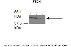 Lanes:   1. (FECH 抗体  (Middle Region))