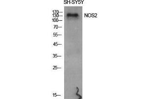 Western Blot (WB) analysis of specific cells using NOS2 Polyclonal Antibody. (NOS2 抗体  (Thr177))