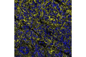 Immunofluorescence (IF) image for anti-Poliovirus Receptor-Related 2 (Herpesvirus Entry Mediator B) (PVRL2) (AA 50-100) antibody (ABIN7449542)