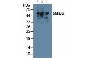 Western blot analysis of (1) Rat Liver Tissue, (2) Mouse RAW 2647 Cells and (3) Rat Brain Tissue. (TXNRD1 抗体  (AA 208-433))