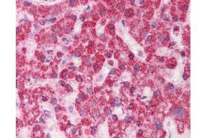 Anti-TST antibody IHC staining of human liver. (TST 抗体  (Middle Region))