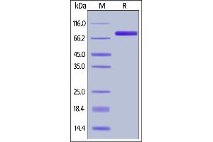 SDS-PAGE (SDS) image for Colony Stimulating Factor 2 Receptor, Alpha, Low-Affinity (Granulocyte-Macrophage) (CSF2RA) (AA 23-320) (Active) protein (Fc Tag) (ABIN6809935)
