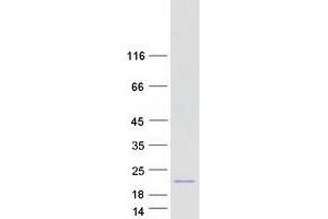 Western Blotting (WB) image for Luteinizing Hormone beta Polypeptide (LHB) protein (Myc-DYKDDDDK Tag) (ABIN2725027)
