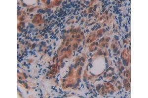 Used in DAB staining on fromalin fixed paraffin- embedded thyroid tissue (OSBP 抗体  (AA 546-807))