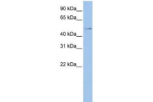 WB Suggested Anti-TSPYL4 Antibody Titration: 0. (TSPY-Like 4 抗体  (Middle Region))
