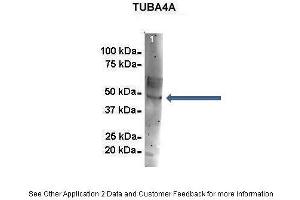 Immunoprecipitation (IP) image for anti-Tubulin, alpha 4a (TUBA4A) (Middle Region) antibody (ABIN2778649)