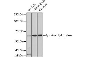 Western blot analysis of extracts of various cell lines, using Tyrosine Hydroxylase Rabbit mAb (ABIN1682210, ABIN3019364, ABIN3019365 and ABIN7101758) at 1:1000 dilution. (PNPT1 抗体)