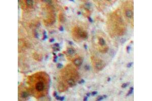 Used in DAB staining on fromalin fixed paraffin-embedded Liver tissue (PLA2G7 抗体  (AA 22-441))