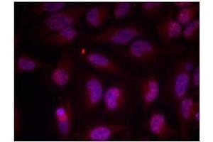 Image no. 1 for anti-Myc Proto-Oncogene protein (MYC) (pThr358) antibody (ABIN196675) (c-MYC 抗体  (pThr358))