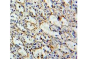 Used in DAB staining on fromalin fixed paraffin-embedded Spleen tissue (LAT 抗体  (AA 33-227))