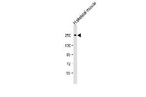 Anti-MYH4 Antibody (N-Term) at 1:2000 dilution + human skeletal muscle lysate Lysates/proteins at 20 μg per lane. (MYH4 抗体  (AA 482-515))