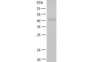 Western Blotting (WB) image for Aminoacylase 1 (ACY1) (AA 1-408) protein (His tag) (ABIN7121809) (Aminoacylase 1 Protein (ACY1) (AA 1-408) (His tag))