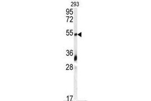 Image no. 1 for anti-Growth Differentiation Factor 10 (GDF10) (N-Term) antibody (ABIN357454) (GDF10 抗体  (N-Term))