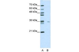 WB Suggested Anti-MDS032  Antibody Titration: 0. (Use1 抗体  (N-Term))