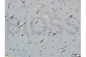 Formalin-fixed and paraffin embedded rat brain tissue labeled with Rabbit Anti-Neuroligin 1 Polyclonal Antibody (ABIN705311) at 1:200 followed by conjugation to the secondary antibody and DAB staining.