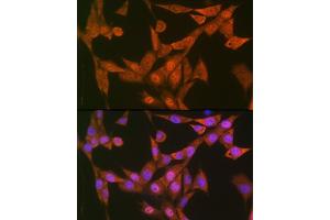 Immunofluorescence analysis of NIH-3T3 cells using LTH Rabbit mAb (ABIN7268244) at dilution of 1:100 (40x lens). (LTA4H 抗体)