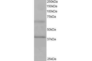 Western Blotting (WB) image for anti-Ankyrin Repeat and BTB (POZ) Domain Containing 1 (ABTB1) (C-Term) antibody (ABIN2465340) (ABTB1 抗体  (C-Term))