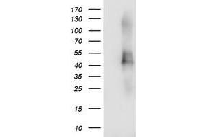 Western Blotting (WB) image for anti-Transmembrane Protein with EGF-Like and Two Follistatin-Like Domains 2 (TMEFF2) antibody (ABIN1501417) (TMEFF2 抗体)