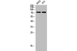 Western blot analysis of K562 3T3 lysate, antibody was diluted at 500. (Endoglin 抗体  (AA 370-430))
