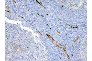 IHC analysis of Bcl-XL using anti-Bcl-XL antibody . (BCL2L1 抗体  (AA 1-219))