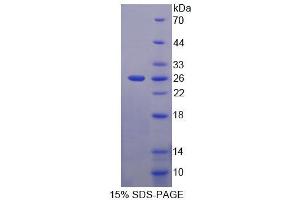 SDS-PAGE analysis of Human ACD Protein. (ACD 蛋白)