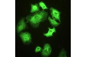 Detection of HSPA1A in A549 cells using Polyclonal Antibody to Heat Shock 70 kDa Protein 1A (HSPA1A) (HSP70 1A 抗体  (AA 1-641))