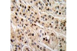 Immunohistochemistry (IHC) image for anti-Proliferating Cell Nuclear Antigen (PCNA) (AA 231-261) antibody (ABIN3032321)