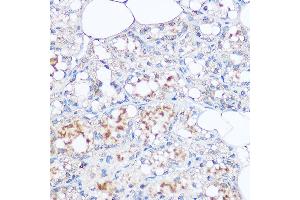 Immunohistochemistry of paraffin-embedded rat breast using MGP Rabbit pAb (ABIN6128268, ABIN6143825, ABIN6143826 and ABIN6221090) at dilution of 1:100 (40x lens).