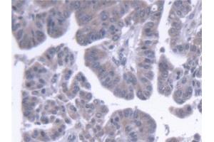 Immunohistochemistry (IHC) image for anti-ER Lipid Raft Associated 2 (ERLIN2) (AA 47-339) antibody (ABIN7441649)