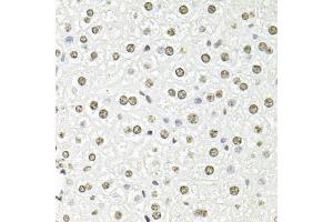 Immunohistochemistry of paraffin-embedded mouse liver using FBL antibody (ABIN6292110) at dilution of 1:100 (40x lens).