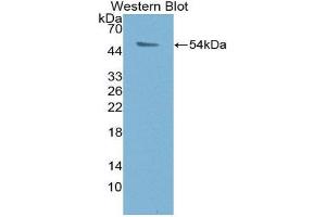 Western Blotting (WB) image for anti-Proteasome (Prosome, Macropain) 26S Subunit, ATPase, 1 (PSMC1) (AA 1-440) antibody (ABIN3204524) (PSMC1 抗体  (AA 1-440))