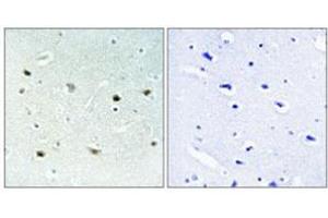 Immunohistochemical staining of human brain (left). (MAPK15 抗体  (pThr175, pTyr177))
