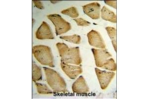 Immunohistochemistry (Paraffin-embedded Sections) (IHC (p)) image for anti-Microfibrillar Associated Protein 5 (MFAP5) (AA 133-160), (C-Term) antibody (ABIN391487)