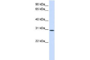 WB Suggested Anti-KIAA0247 Antibody Titration:  0. (SUSD6/KIAA0247 抗体  (N-Term))