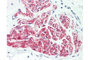 Anti-L1CAM antibody IHC staining of human peripheral nerve. (L1CAM 抗体  (AA 1154-1182))