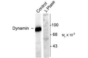 Image no. 1 for anti-Dynamin 1 (DNM1) (pSer778) antibody (ABIN372617) (Dynamin 1 抗体  (pSer778))