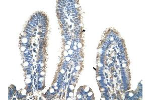 APCS antibody was used for immunohistochemistry at a concentration of 4-8 ug/ml to stain Epithelial cells of intestinal villus (arrows) in Human Intestine. (APCS 抗体  (N-Term))