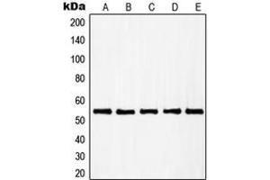 Western blot analysis of RAD23B expression in A431 (A), HuvEc (B), HEK293 (C), HeLa (D), HT29 (E) whole cell lysates. (RAD23B 抗体  (N-Term))
